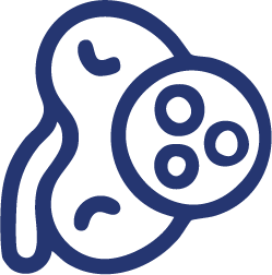 Ícono de litotripsia láser